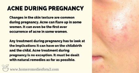 Acne During Pregnancy