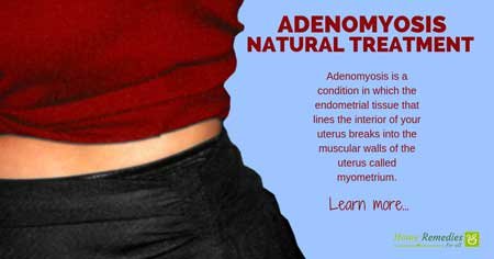 adenomyosis natural treatment