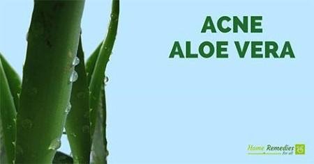 Aloe vera for acne scars