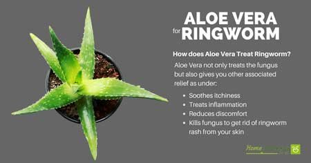 aloe vera for ringworm