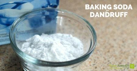 baking soda for dandruff