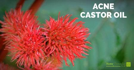 Castor plant