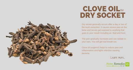 clove oil for dry socket