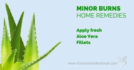 Aloe vera for minor burns