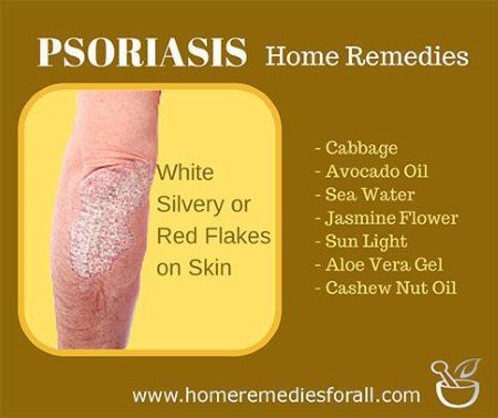 Home Remedies for Psoriasis