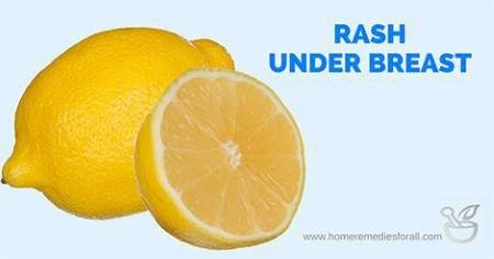 Lemon juice for rash