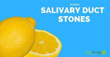 Lemons for salivary duct stones
