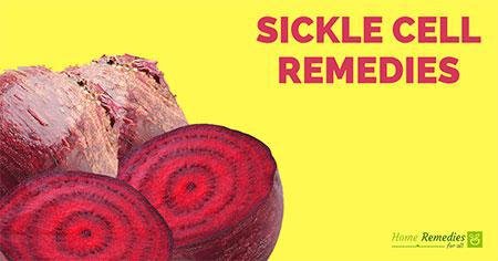 Beet Roots for sickle cell anemia