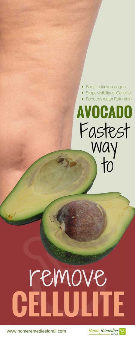 avocado for cellulite infographic