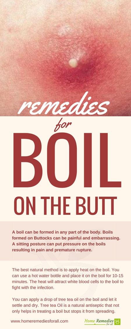 boil on butt infographic