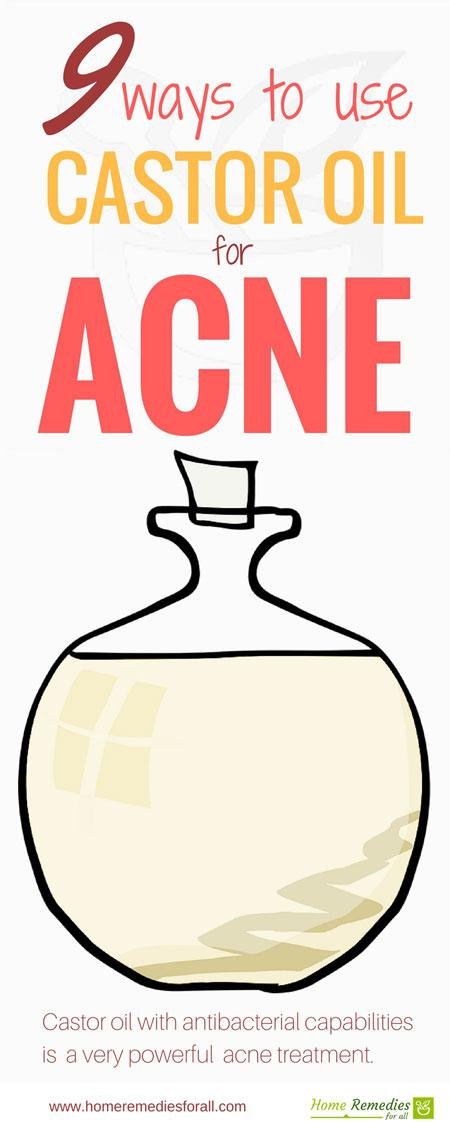 castor oil for acne infographic