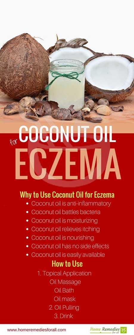 coconut oil for eczema infographic