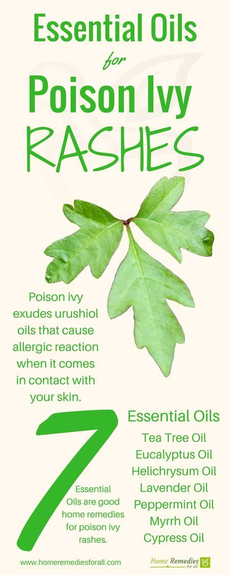 essential oils for poison ivy infographic