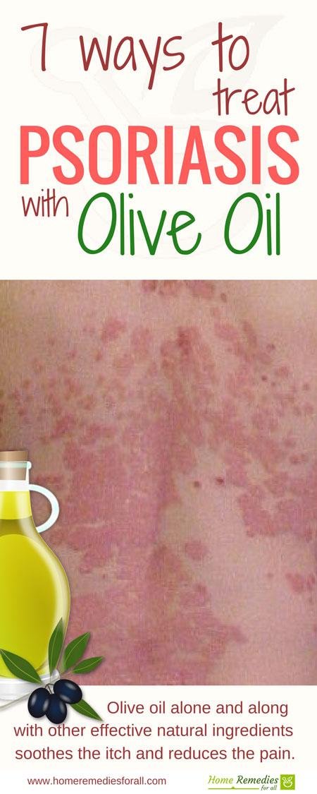 olive oil for psoriasis infographic