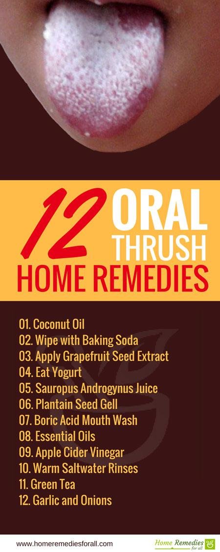 oral thrush remedies infographic