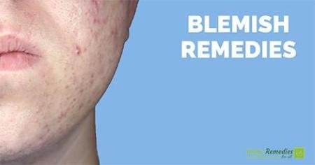 Blemishes caused by acne