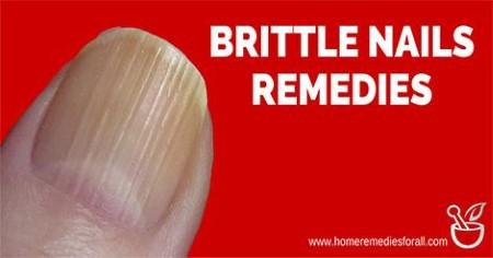 Brittle nail
