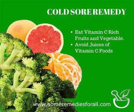 Picture of Cold Sore Remedies Vitamin C