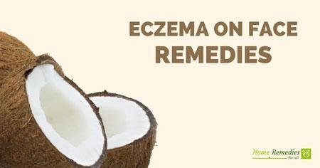 eczema on face