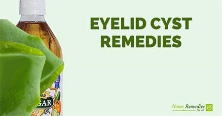 Aloe Vera for Eyelid Cyst
