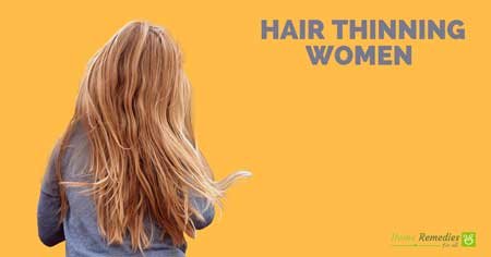 hair loss treatment for women
