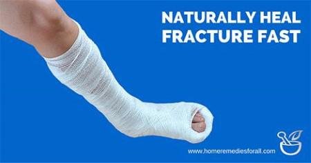 Broken legs 