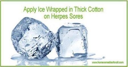 Natural Herpes Home remedies Ice Cubes