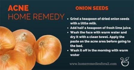 Onion Seeds