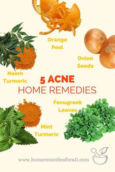 5 Home Remedies for Acne