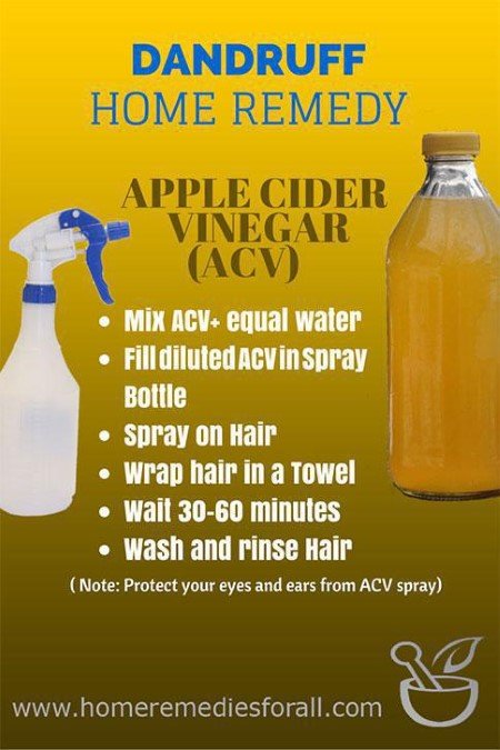 Picture of Home Remedies for Dandruff Apple Cider Vinegar