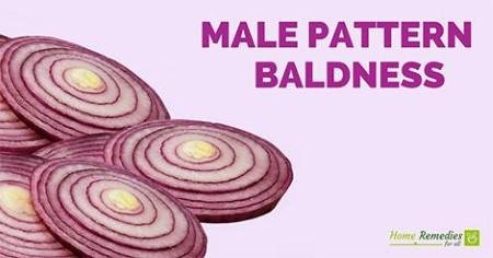 Onions for baldness
