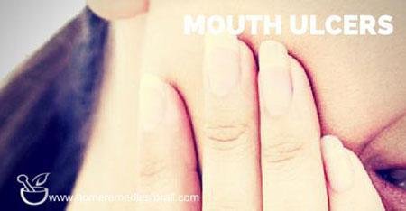 Mouth ulcer pain