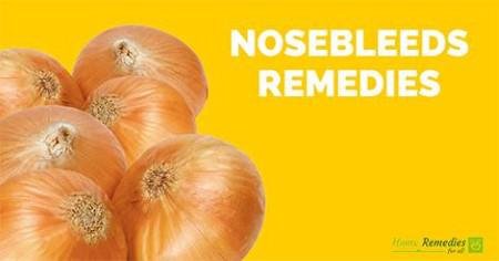 Onions for nosebleed