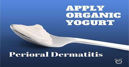 Yogurt for perioral dermatitis