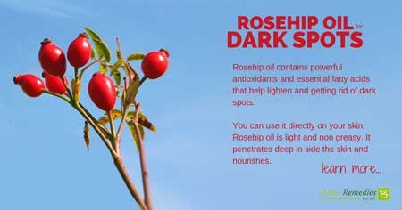 rosehip oil for dark spots