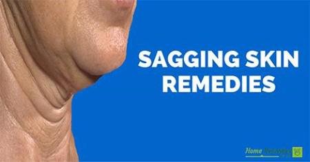 Sagging skin