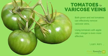 tomatoes for varicose veins
