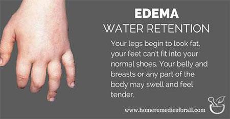 Water Retention